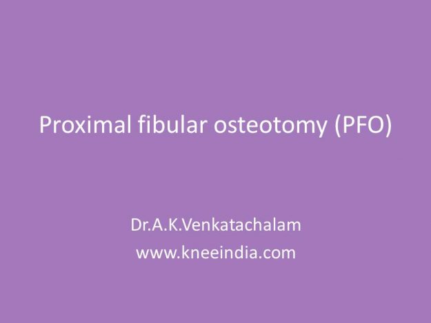 Proximal Fibular Osteotomy India