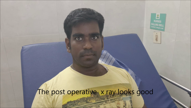 Knee fracture fixation Chennai Best rated orthopaedic surgeon Chennai