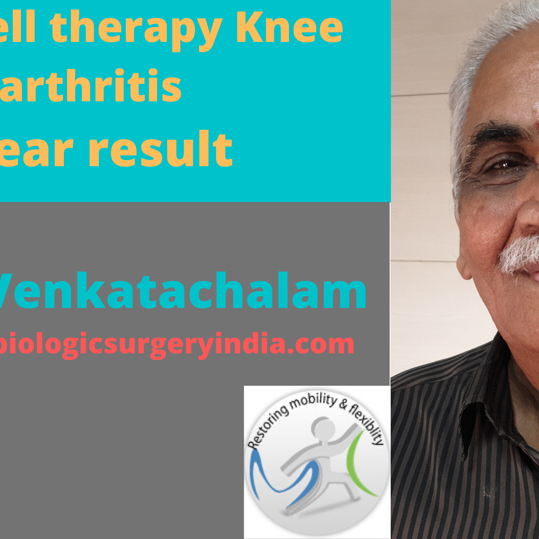 Cellular therapy knee arthritis