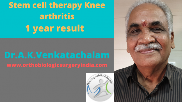 Cellular therapy Knee arthritis Cellular therapy knee arthritis