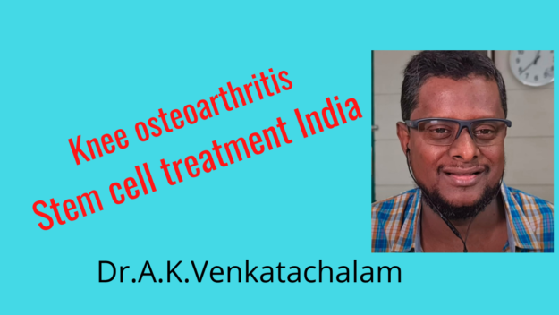 Add a heading (3) Knee pain relieved by stem cell treatment India