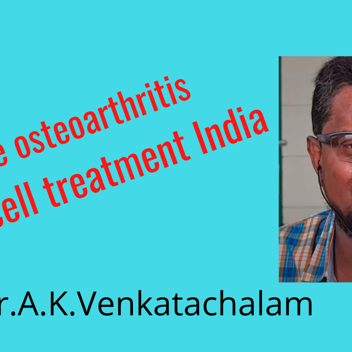 Knee pain relieved by stem cell treatment India