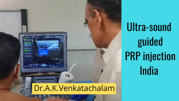 Ultra-sound guided shoulder PRP injection India Ultra-sound guided shoulder PRP injection India