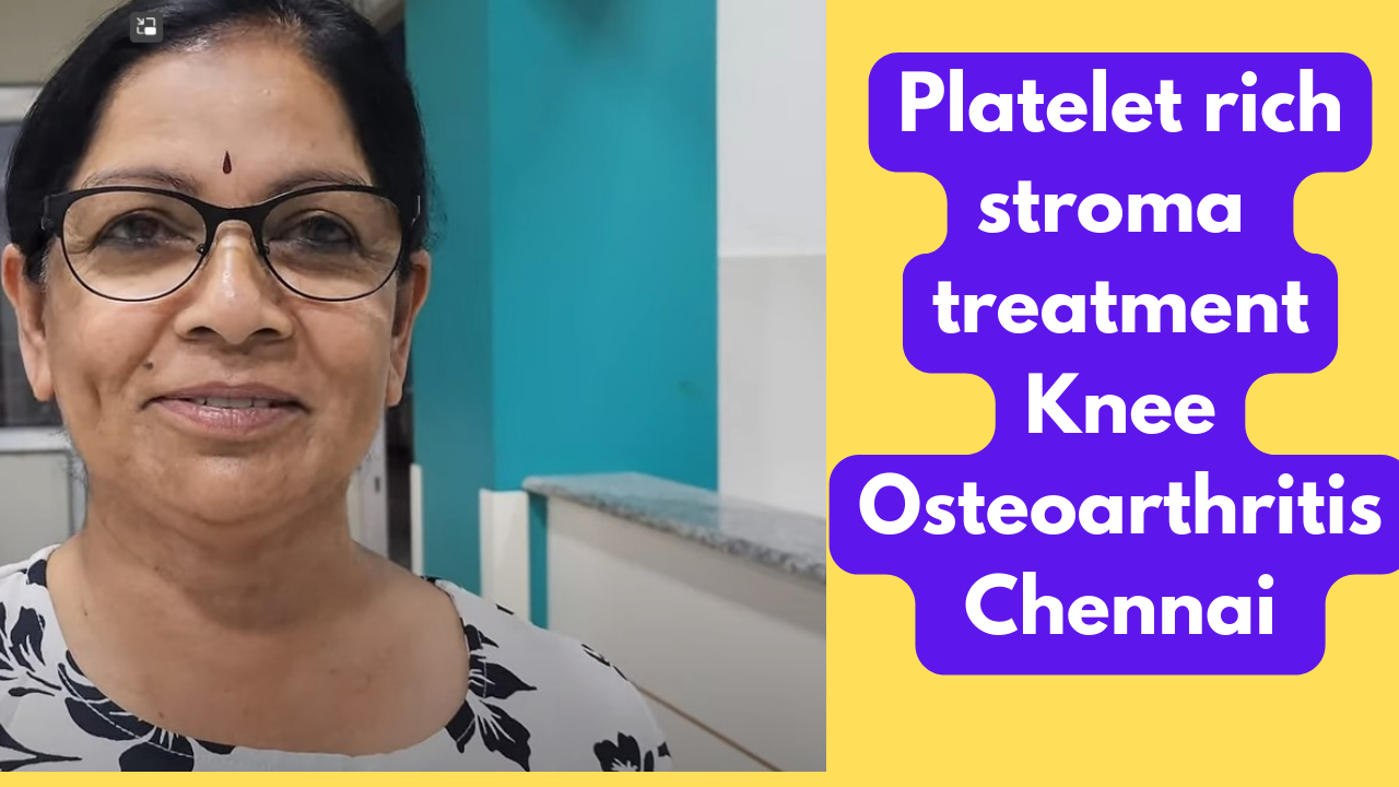 Platelet rich stroma treatment Knee Osteoarthritis Chennai (1) Platelet rich stroma treatment knee osteoarthritis Chennai.