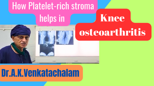 Add a heading (1) How Platelet-rich stroma helps in knee osteoarthritis